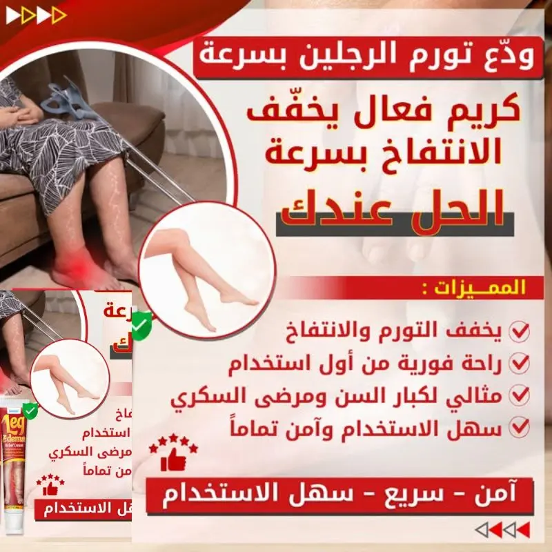 قل وداعاً  من تورم الساقين أو احتباس السوائل