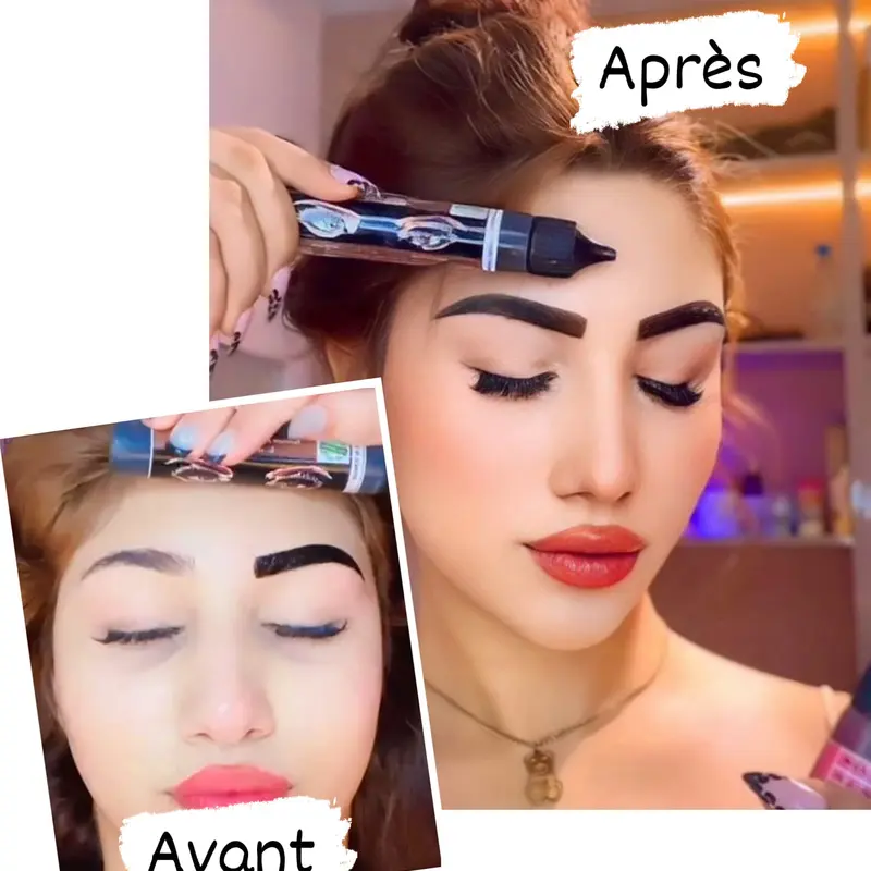 نتائج الحواجب قبل وبعد