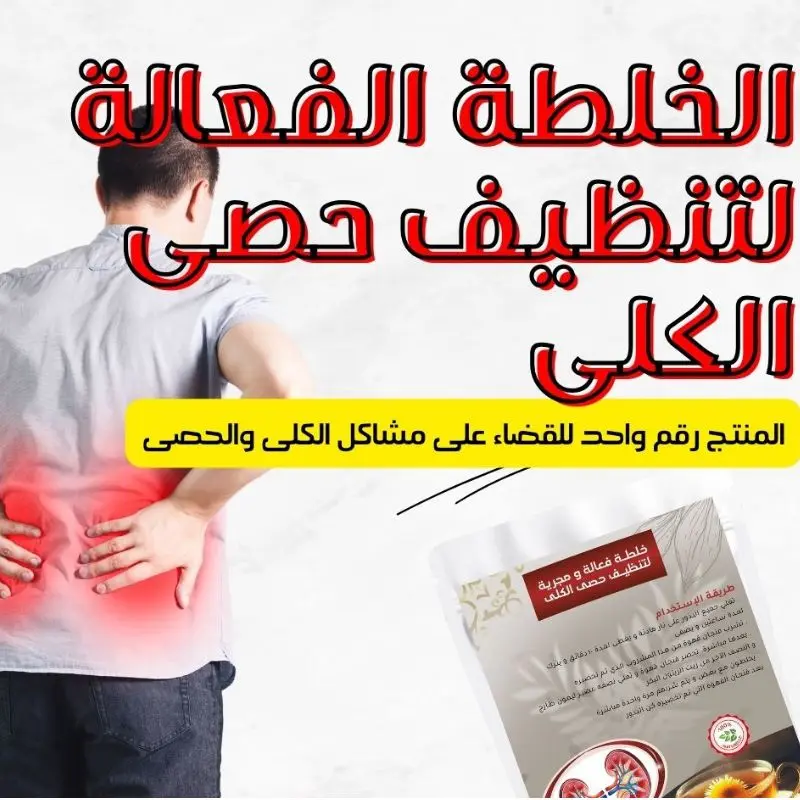 علاج طبيعى لحصى الكلى دون عملية جراحية